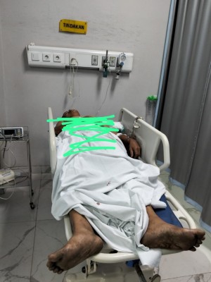 Terpergok Curi Motor, AM Babak Belurd Dihajar Warga
